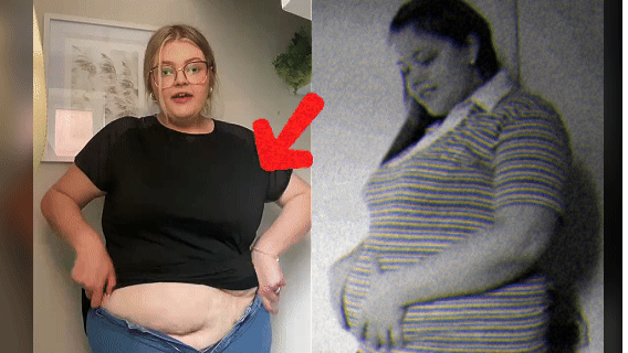 CitrusBurn before and after transformation – real user result